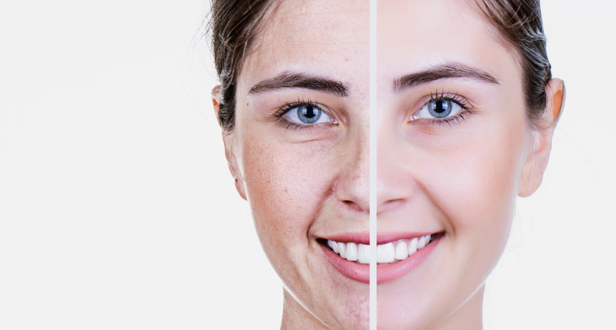 How Does Triple Anti Solution Help Reduce Signs of Aging?
